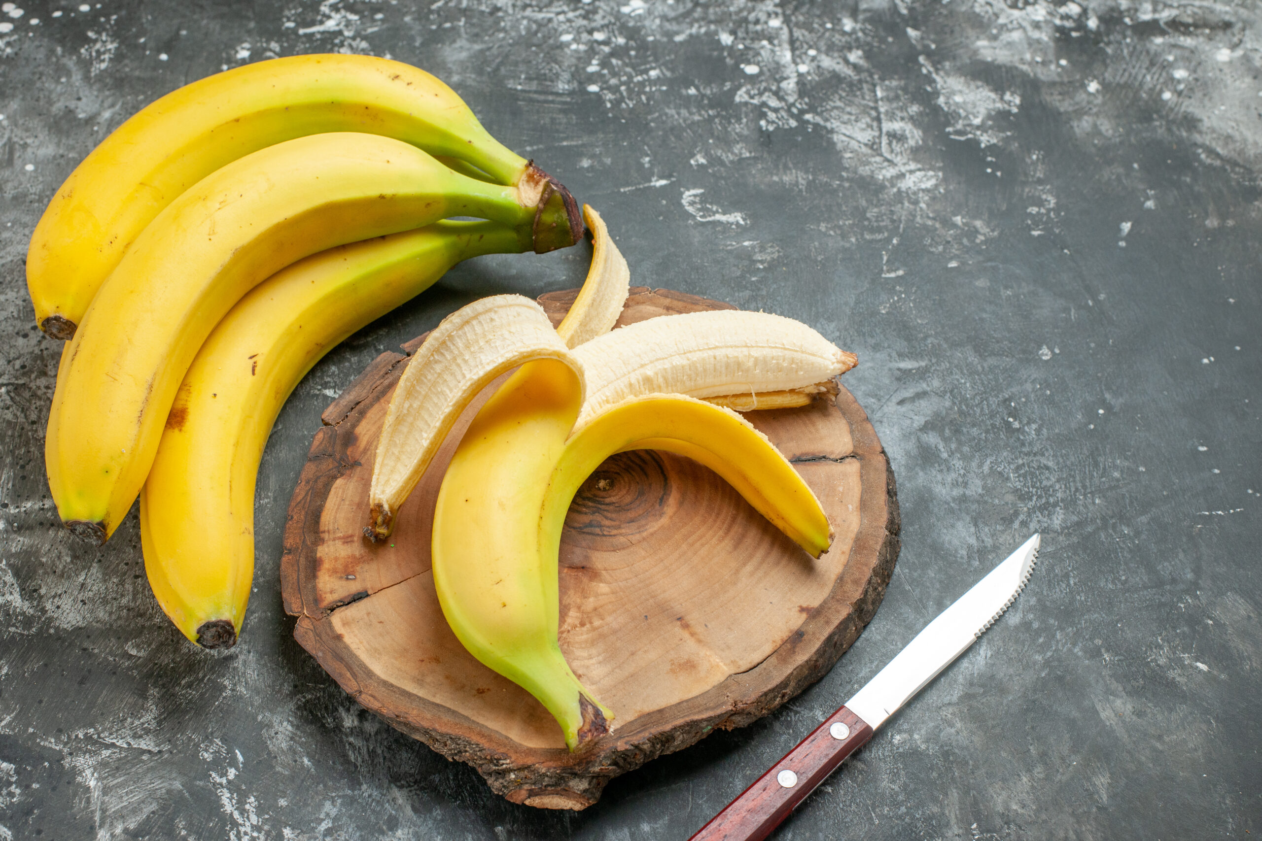 #10 Incredible Health Benefits Of Bananas